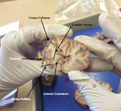 Inside The Brain The Sheep S Brain